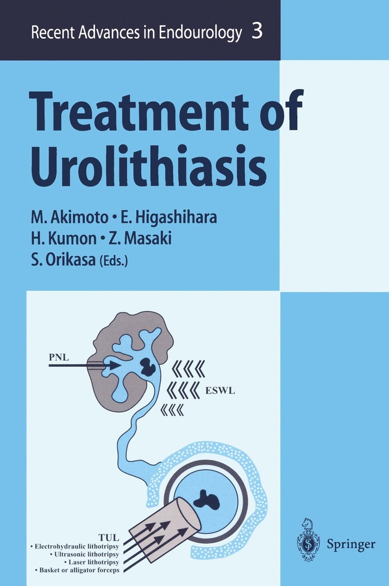 Treatment of Urolithiasis 1