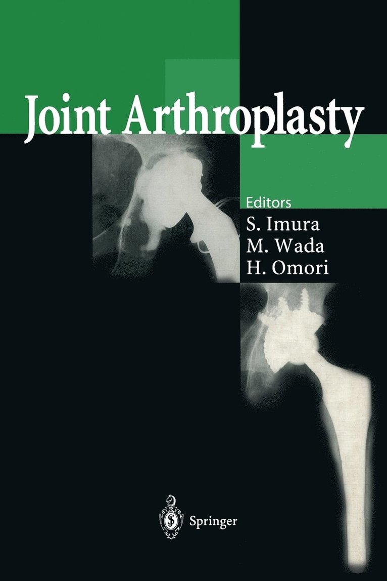 Joint Arthroplasty 1