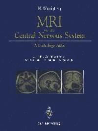bokomslag MRI of the Central Nervous System