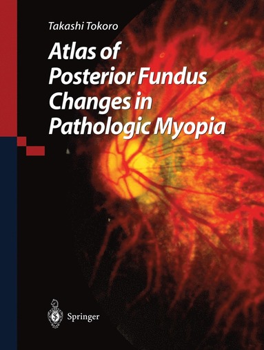 bokomslag Atlas of Posterior Fundus Changes in Pathologic Myopia