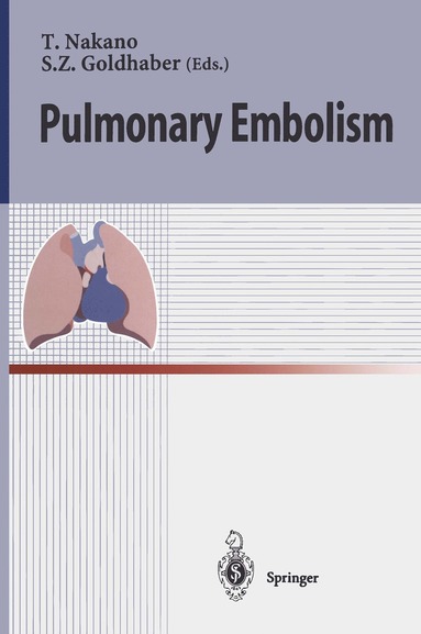 bokomslag Pulmonary Embolism