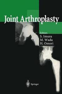 bokomslag Joint Arthroplasty