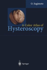 bokomslag A Color Atlas of Hysteroscopy
