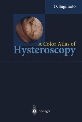 Osamu Sugimoto - Color Atlas of Hysteroscopy, Inbunden