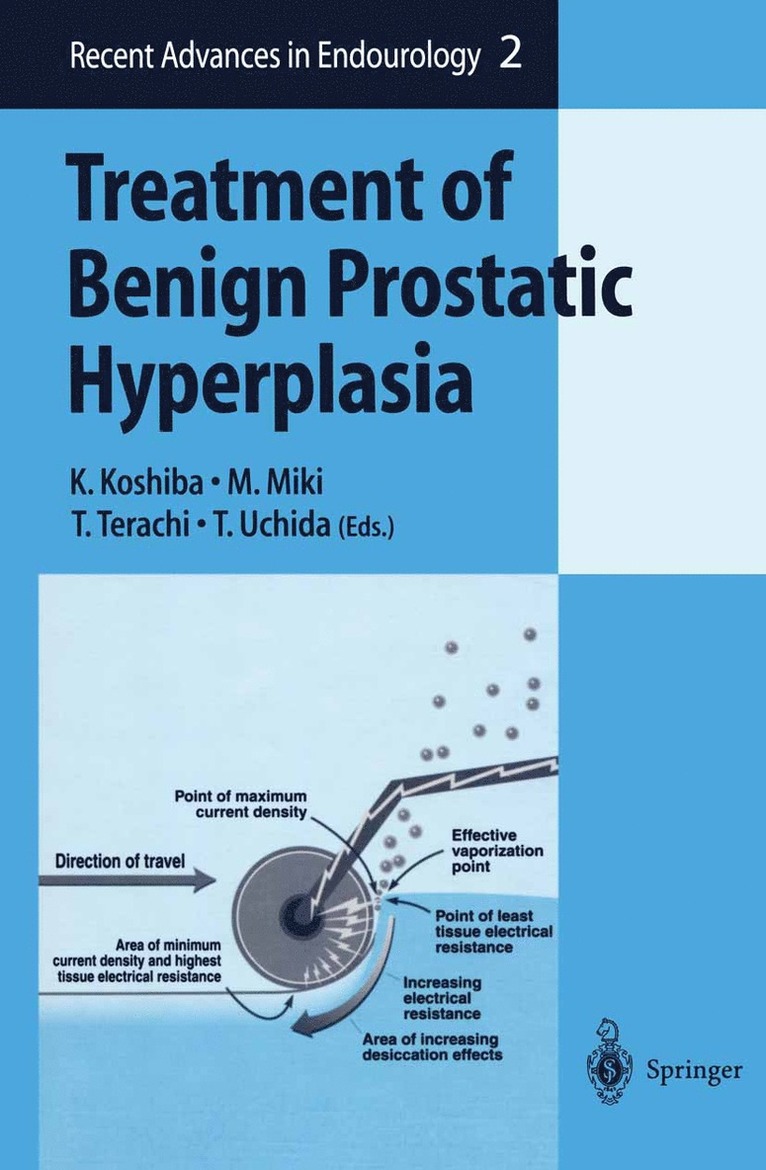 K. Koshiba, M. Miki, T. Terachi, T. Uchida - Treatment of Benign Prostatic Hyperplasia, Inbunden