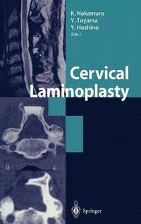 bokomslag Cervical Laminoplasty