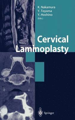 K. Nakamura, Y. Toyama, Y. Hoshino - Cervical Laminoplasty, Inbunden