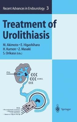 bokomslag Treatment of Urolithiasis