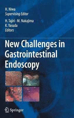 Hisao Tajiri, Masatsugu Nakajima, Kenjiro Yasuda - New Challenges in Gastrointestinal Endoscopy, Inbunden