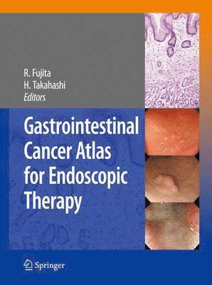 Rikiya Fujita, Hiroshi Takahashi - Gastrointestinal Cancer Atlas for Endoscopic Therapy, Inbunden