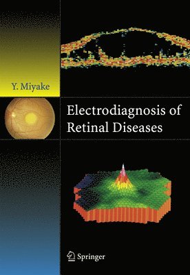 Yozo Miyake - Electrodiagnosis of Retinal Disease, Häftad