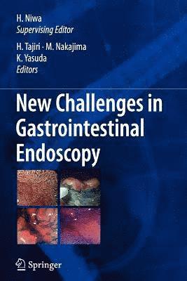 bokomslag New Challenges in Gastrointestinal Endoscopy