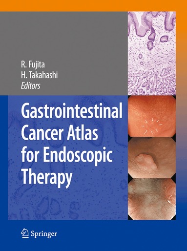 Rikiya Fujita, Hiroshi Takahashi - Gastrointestinal Cancer Atlas for Endoscopic Therapy, Häftad