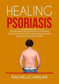 bokomslag Healing Psoriasis