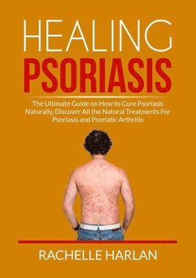 Healing Psoriasis 1