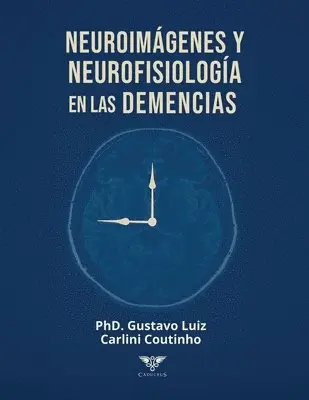 Gustavo Luiz Carlini Coutinho, Grupo Ígneo - Neuroimágenes y neurofisiología en las demencias, Häftad. Tillgänglighet: Lägg i varukorg