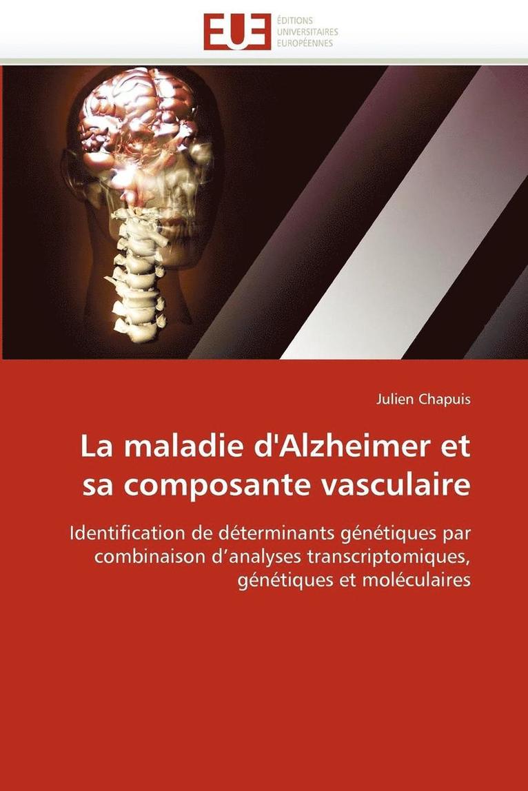 La Maladie d''alzheimer Et Sa Composante Vasculaire 1