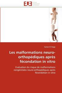 bokomslag Les Malformations Neuro-Orthop diques Apr s F condation in Vitro