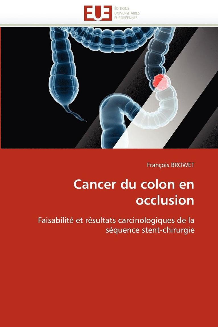 Cancer Du Colon En Occlusion 1