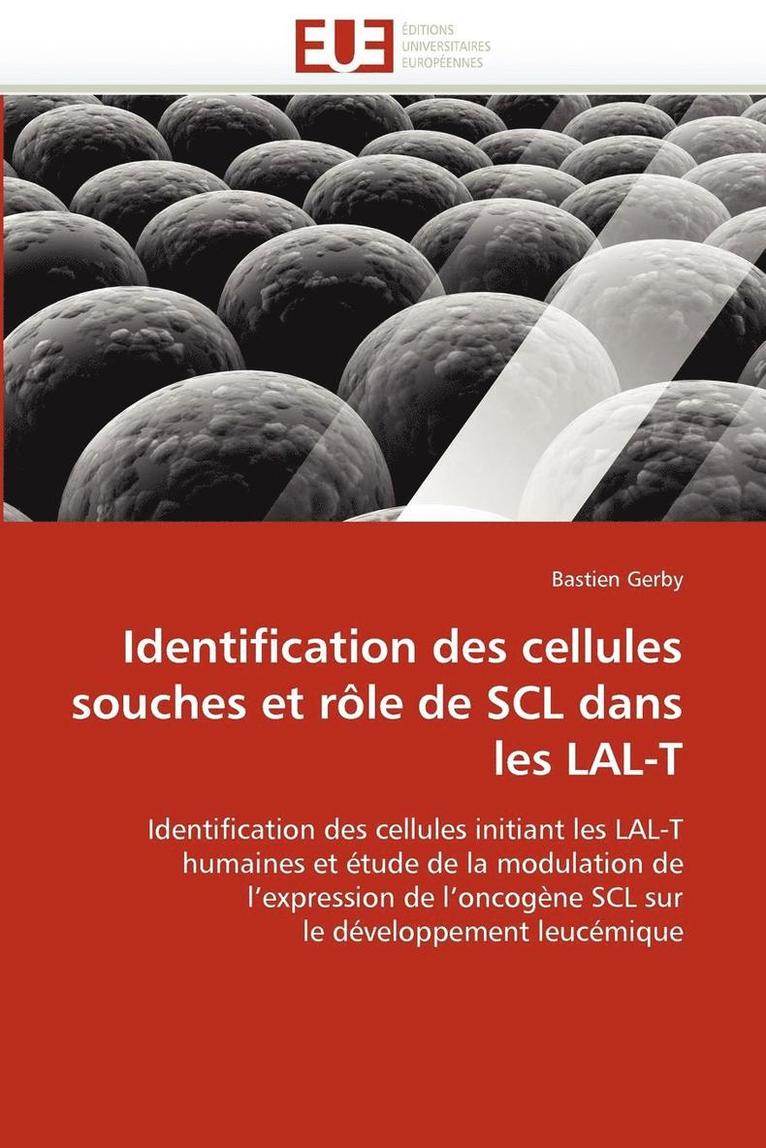 Identification Des Cellules Souches Et R le de Scl Dans Les Lal-T 1