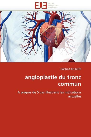bokomslag Angioplastie Du Tronc Commun