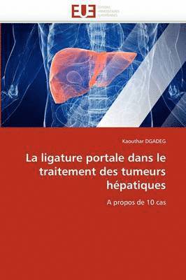 bokomslag La Ligature Portale Dans Le Traitement Des Tumeurs H patiques