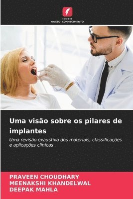 Praveen Choudhary, Meenakshi Khandelwal, Deepak Mahla, PRAVEEN CHOUDHARY - Uma visão sobre os pilares de implantes, Häftad