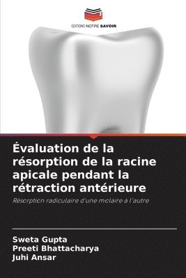 bokomslag Évaluation de la résorption de la racine apicale pendant la rétraction antérieure