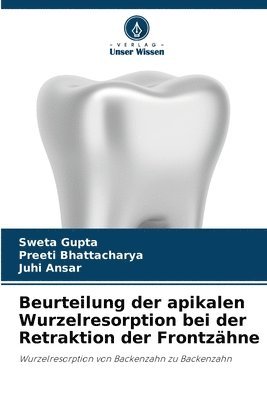 bokomslag Beurteilung der apikalen Wurzelresorption bei der Retraktion der Frontzähne