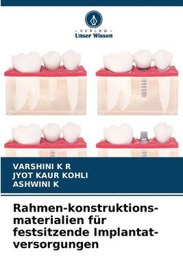 Rahmen-konstruktions-materialien für festsitzende Implantat-versorgungen