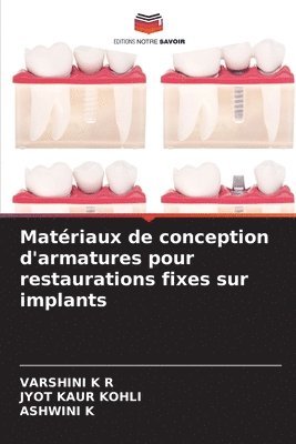 Matériaux de conception d'armatures pour restaurations fixes sur implants