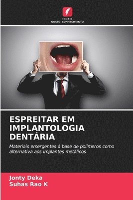 Jonty Deka, Suhas Rao K, Suhas Rao K., SUHAS RAO K - Espreitar Em Implantologia Dentária, Häftad