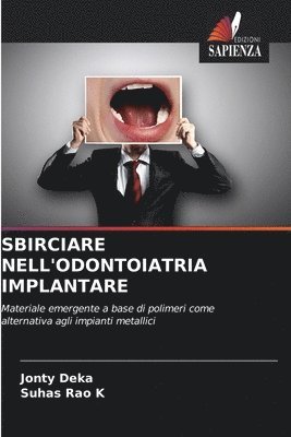 Jonty Deka, Suhas Rao K, Suhas Rao K., SUHAS RAO K - Sbirciare Nell'odontoiatria Implantare, Häftad
