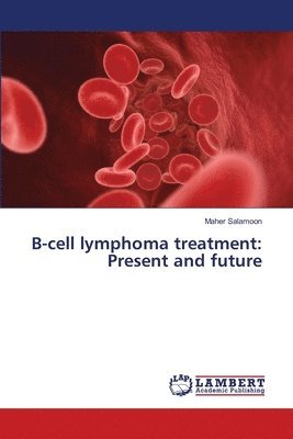 B-cell lymphoma treatment 1