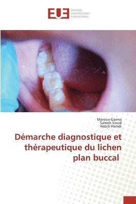 bokomslag Démarche diagnostique et thérapeutique du lichen plan buccal