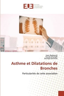 Asthme et Dilatations de Bronches 1