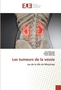bokomslag Les tumeurs de la vessie