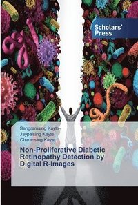 bokomslag Non-Proliferative Diabetic Retinopathy Detection by Digital R-Images