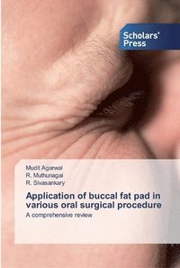 bokomslag Application of buccal fat pad in various oral surgical procedure