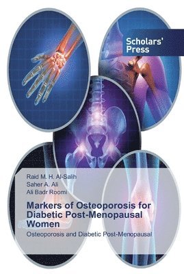 Markers of Osteoporosis for Diabetic Post-Menopausal Women 1