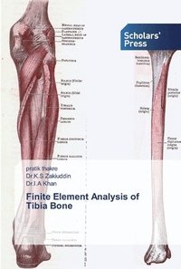 bokomslag Finite Element Analysis of Tibia Bone