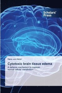 bokomslag Cytotoxic brain tissue edema