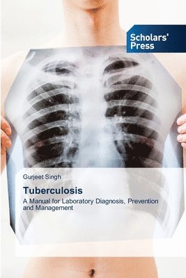 bokomslag Tuberculosis