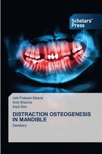 bokomslag Distraction Osteogenesis in Mandible