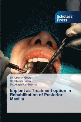 bokomslag Implant as Treatment option in Rehabilitation of Posterior Maxilla