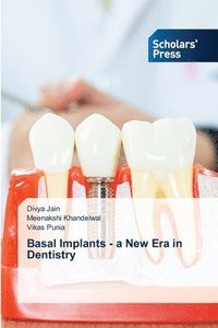 bokomslag Basal Implants - a New Era in Dentistry