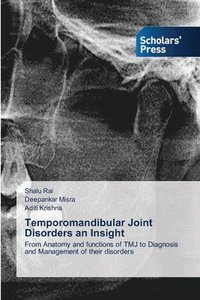 bokomslag Temporomandibular Joint Disorders an Insight