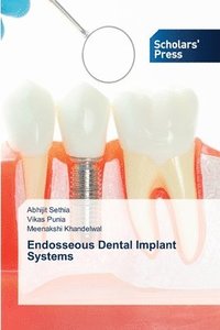 bokomslag Endosseous Dental Implant Systems