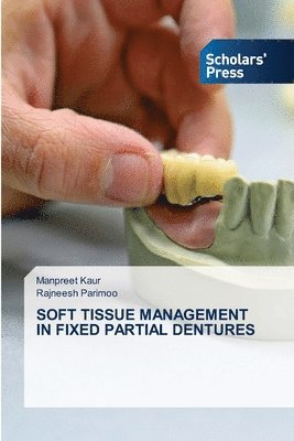 Soft Tissue Management in Fixed Partial Dentures 1