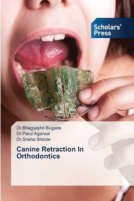 Canine Retraction In Orthodontics 1